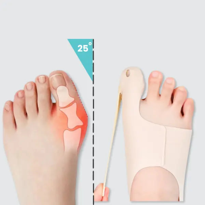 Hallux korektor sleeve